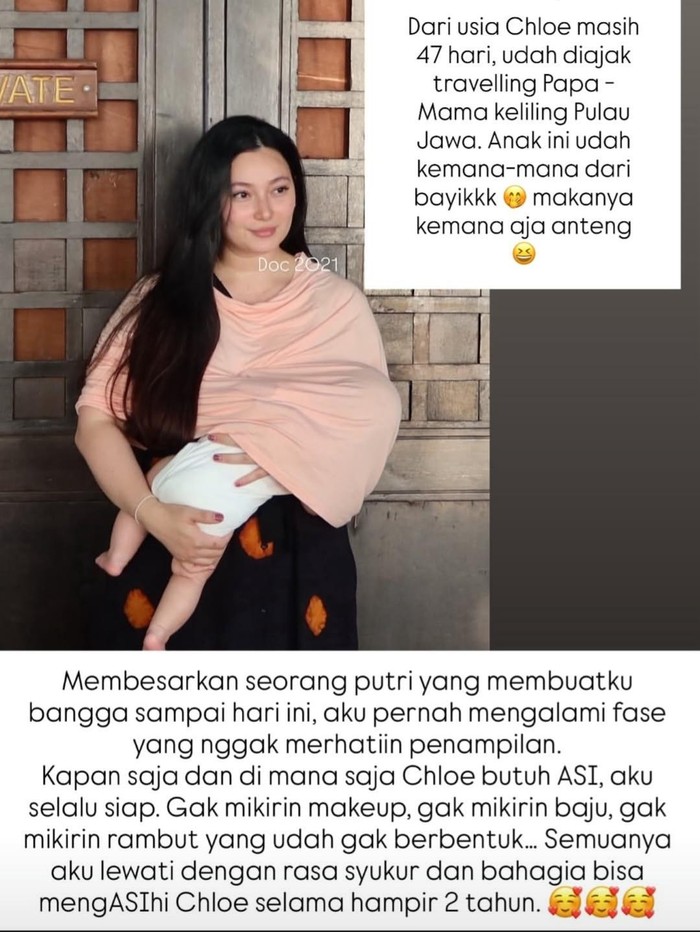 Asmirandah pilih melakukan liposuction atau sedot lemak untuk kecilkan lingkar paha dan lengan.