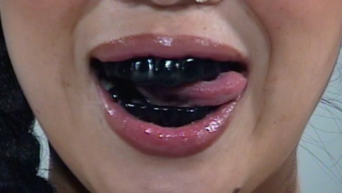 Tren teeth blackening
