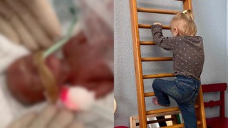 Kisah Haru Balita Tumbuh Sehat Setelah Lahir Prematur di Usia 24 Minggu