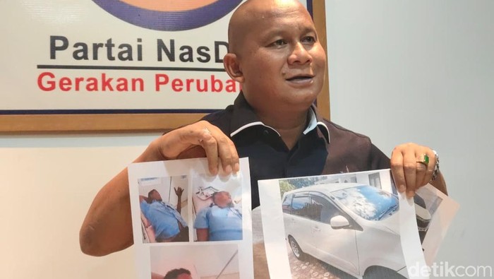 Anggota DPRD Sumut Rahmansyah Sibarani saat memperlihatkan korban luka dan mobil yang rusak akibat kericuhan