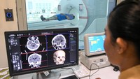 Indonesia Jadi Negara Pertama di Asia Pakai CT Scan Photon Counting