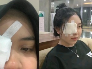 Medsos Kosmetik Pinkflash Digeruduk Konsumen, Keluhkan Iritasi Mata hingga Insisi