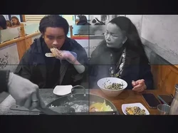 Foto Jennifer Jill-Ajun Perwira Oplas di Korea, Ini Hasilnya Setelah 8 Bulan