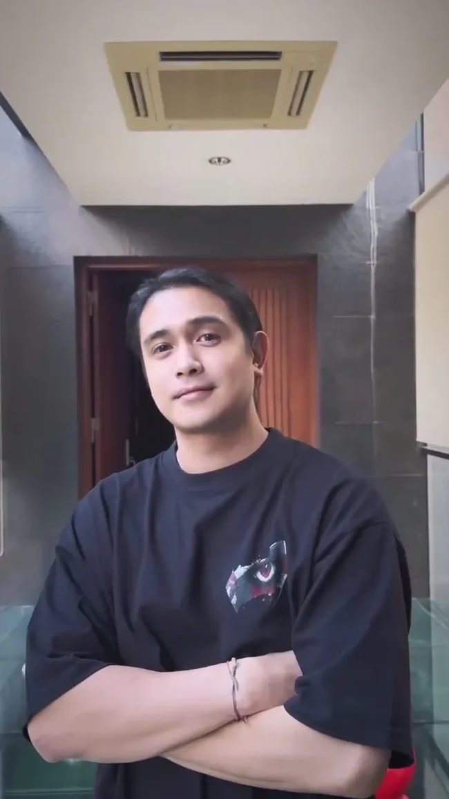 Begini penampilan Ajun setelah 8 bulan pasca operasi. Garis rambutnya kini terlihat lebih maju dan rambutnya pun tampak lebih tebal. Ajun sendiri diketahui menjalani transplantasi rambut di bagian depan dan atas. Foto: Instagram/@ajunperwira/@jennifer_ipel/@ab_plasticsurgery_idn