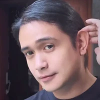 Double chin di dagunya pun tampak sirna. Kini penampilannya jadi terlihat semakin fresh. Foto: Instagram/@ajunperwira/@jennifer_ipel/@ab_plasticsurgery_idn