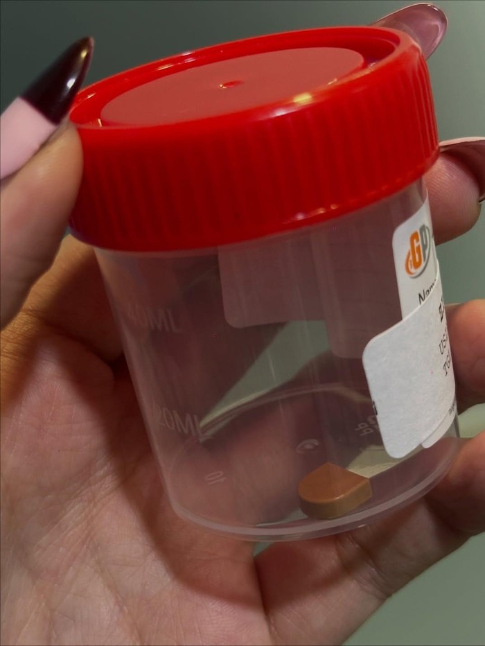 Putri bungsu Joanna Alexandra harus operasi karena hidung kemasukan lego.