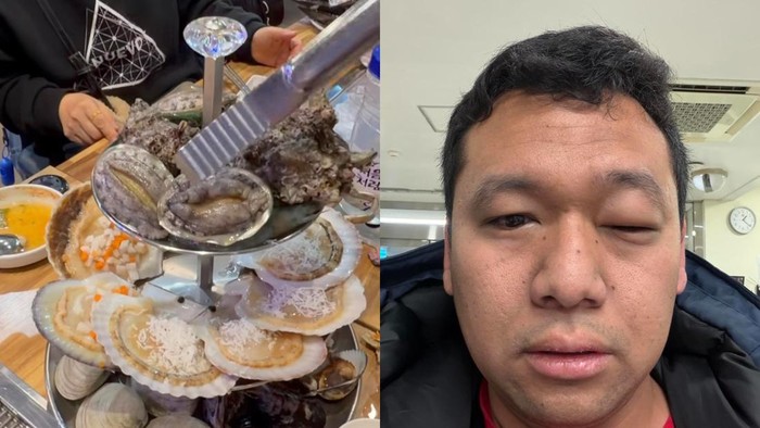 **Racikan Seafood Lezat untuk Menjalani Liburan Tanpa Resiko Alergi**