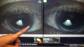 Cek Mata Gratis di Gandaria City, Waspada Mata Kering