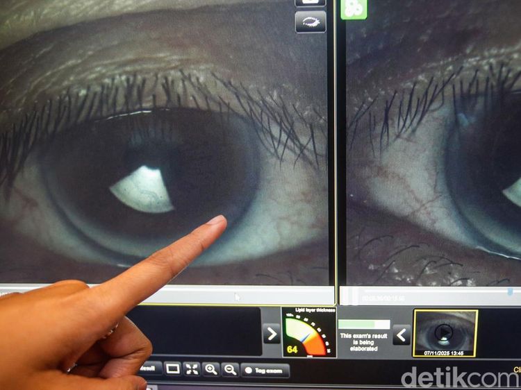 Cek Mata Gratis di Gandaria City, Waspada Mata Kering