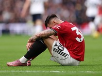 Sesko Sudah Cedera Padahal Belum Perfom Maksimal di MU, Seberapa Parah?