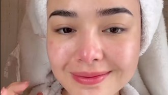 Amanda Manopo Bagikan Rutinitas Skincare, Wajah Aslinya Curi Atensi