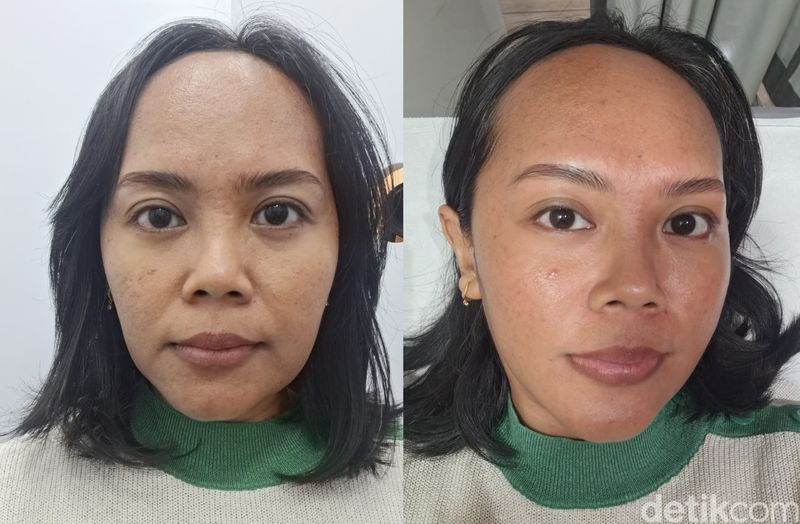 Treatment Glowing Skin di DermiesMAX by Erha.