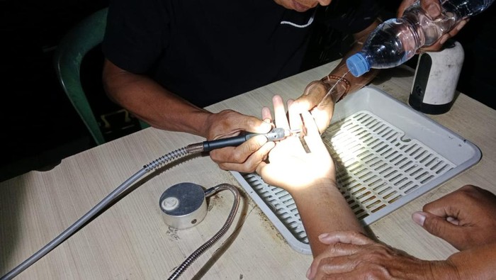 Damkar Kuningan saat mencoba melepaskan cincin di jari seorang anak