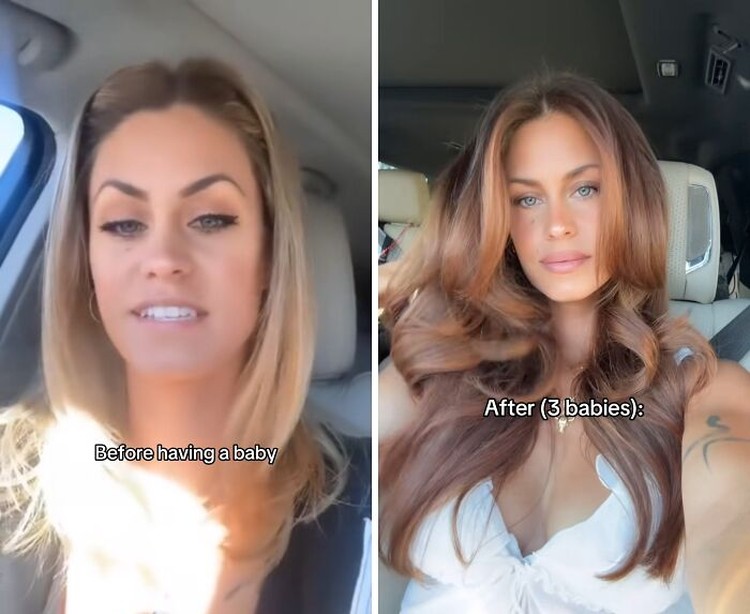 Foto Ibu Sebelum & Sesudah Punya Anak