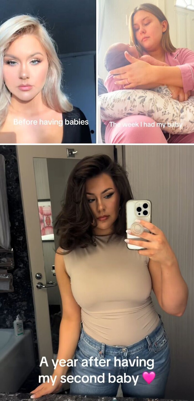 Foto Ibu Sebelum & Sesudah Punya Anak