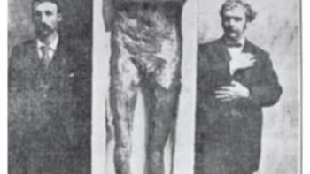 Keaslian gambar ini belum dapat dipastikan, tetapi para ahli sepakat bahwa raksasa dalam foto tersebut tampak sangat nyata. Kerangka raksasa ini ditemukan pada tahun 1912 di Danau Delavan, Wisconsin. Namun, penemuan arkeologi yang mencengangkan ini hanyalah satu dari lusinan penemuan serupa yang dilaporkan di sekitar area tersebut sejak tahun 1851. Pada tanggal 20 Desember 1897, misalnya, Times menulis laporan tentang tiga gundukan pemakaman besar yang telah ditemukan di Maple Creek, Wisconsin. Laporan tersebut menyatakan: “ DI DALAMNYA DITEMUKAN KERANGKA SEORANG PRIA BERUKURAN SANGAT BESAR. TULANG-TULANGNYA BERUKURAN LEBIH DARI SEMBILAN KAKI DARI KEPALA HINGGA KAKI DAN DALAM KONDISI TERAWAT YANG CUKUP BAIK. TENGKORAKNYA SEBESAR UKURAN SETENGAH BUSHEL. BEBERAPA BATANG TEMBAGA YANG DIPERLAKUKAN DENGAN HALUS DAN RELIK-RELIK LAINNYA TERLETAK DI DEKAT TULANG-TULANG ITU .” Foto: Boredpanda