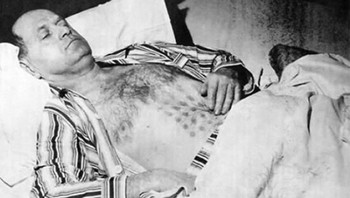 Pada tahun 1697, seorang pria bernama Stefan Michalak mengaku pernah bertemu UFO di dekat Danau Falcon, Kanada. Ia begitu dekat dengan objek tersebut hingga hampir dapat menyentuhnya. Tiba-tiba, UFO tersebut lepas landas dan menjatuhkannya ke tanah. Menurut Stefan, ia terbakar oleh asap knalpot pesawat, yang dibuktikan dengan tanda-tanda kisi-kisi di perut dan dadanya. Ia jatuh sakit setelah kejadian tersebut, tetapi penyebabnya belum diketahui. Sifat luka bakar yang dideritanya masih menjadi misteri. Foto: Boredpanda