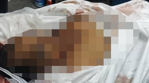 Jenazah Muhammad PMI yang meninggal dunia di Malaysia dengan bekas luka jahitan di beberapa bagian tubuh, Rabu (19/11/2025).
