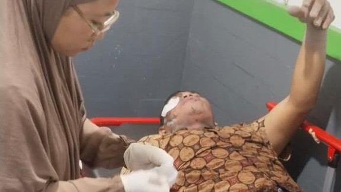 Pasutri asal Desa Maron, Kediri mengalami luka bakar akibat awan panas Semeru saat melintas Gladak Perak.