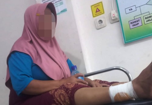 Faizaturrohmi (45), warga Lombok Timur ketika dirawat di Puskesmas karena mengalami luka dibagian kaki setelah digigit anjing liar, Rabu (19/11/2025). (Eva Vebriana)