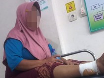 Perempuan di Lombok Timur Diserang Anjing Liar Saat ke Kebun
