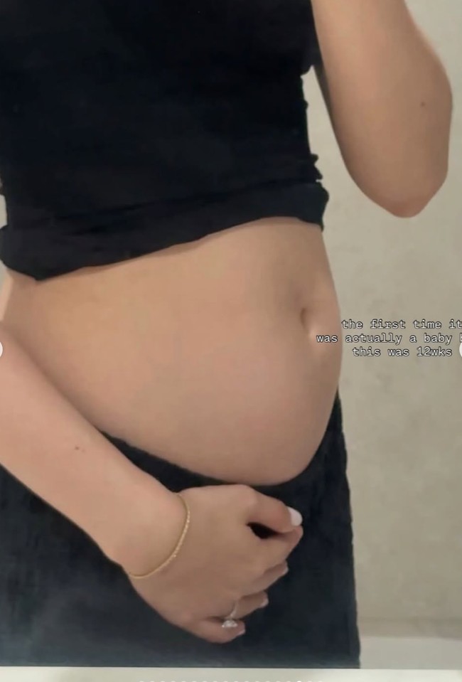 Alyssa juga memamerkan baby bump perdana yang sudah terlihat di perutnya. Baby bump tersebut baru terlihat di usia kehamilan 12 minggu. Foto: Instagram/@alyssadaguise