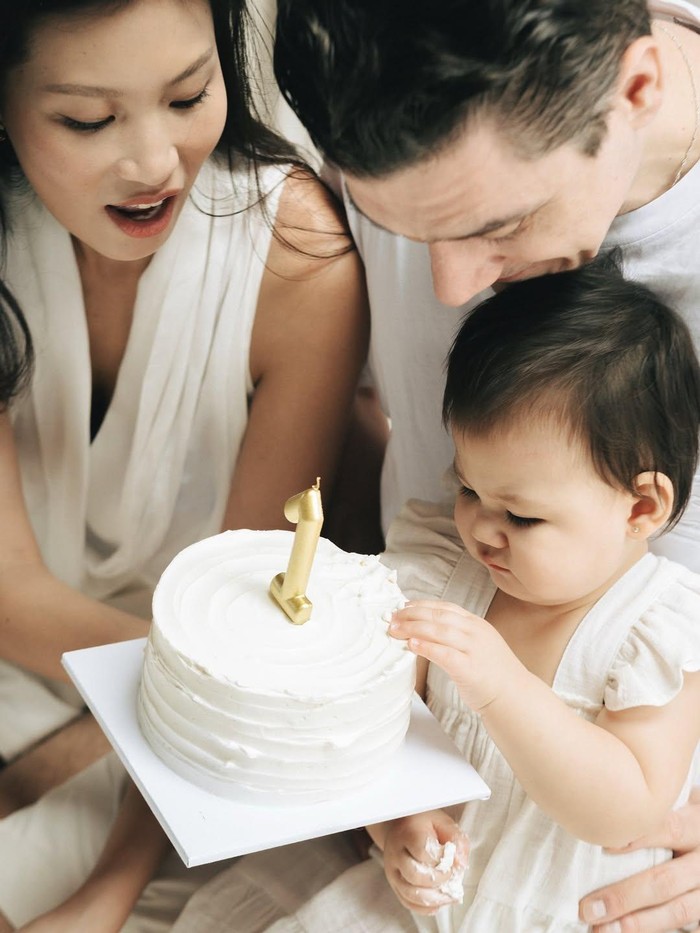 Patricia Gouw ungkap kondisi kepala anak yang mengalami peyang.