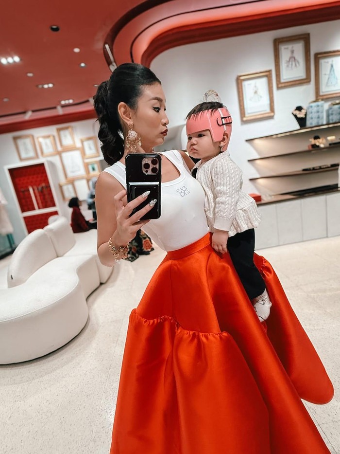 Patricia Gouw ungkap kondisi kepala anak yang mengalami peyang.