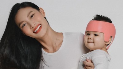 Patricia Gouw Cerita Perkembangan Kondisi Kepala Anak Usai Pakai Helm Khusus