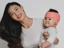 Patricia Gouw Cerita Perkembangan Kondisi Kepala Anak Usai Pakai Helm Khusus