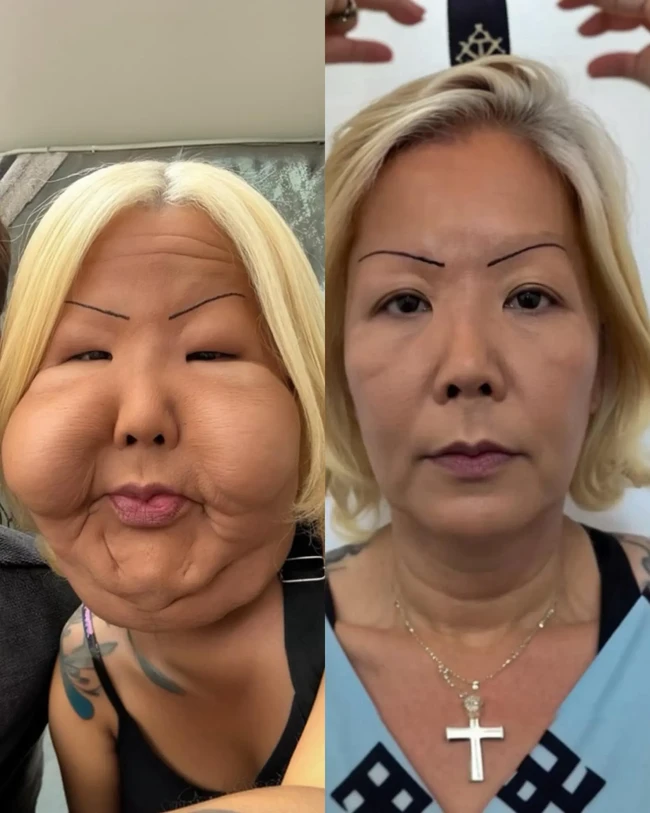 Meski hasil akhirnya belum terlihat, The Sun bahkan membuat visualisasi menggunakan AI untuk memperkirakan seperti apa wajah Juju setelah seluruh prosedur rekonstruksi selesai. Foto: dok. Instagram