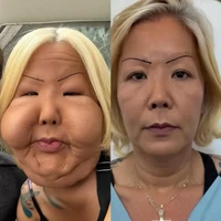 Meski hasil akhirnya belum terlihat, The Sun bahkan membuat visualisasi menggunakan AI untuk memperkirakan seperti apa wajah Juju setelah seluruh prosedur rekonstruksi selesai. Foto: dok. Instagram