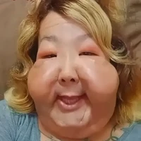 Kondisi tersebut membuat Juju kehilangan kepercayaan diri dan kesulitan mencari pekerjaan. Ia bahkan sempat merasa wajahnya tidak akan pernah kembali seperti semula. Hingga akhirnya, ia menemukan seorang dokter yang bersedia membantu memperbaiki kerusakan tersebut. Foto: dok. Instagram