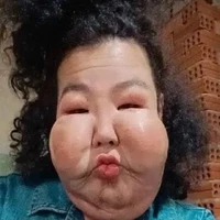 Influencer Brasil, Juliana Oliveira, selama bertahun-tahun harus menanggung rasa malu akibat wajahnya yang berubah setelah menjalani filler di sebuah klinik ilegal. Wanita yang dikenal sebagai Juju itu menjalani prosedur kecantikan yang ternyata bermasalah pada tahun 2017. Foto: dok. Instagram