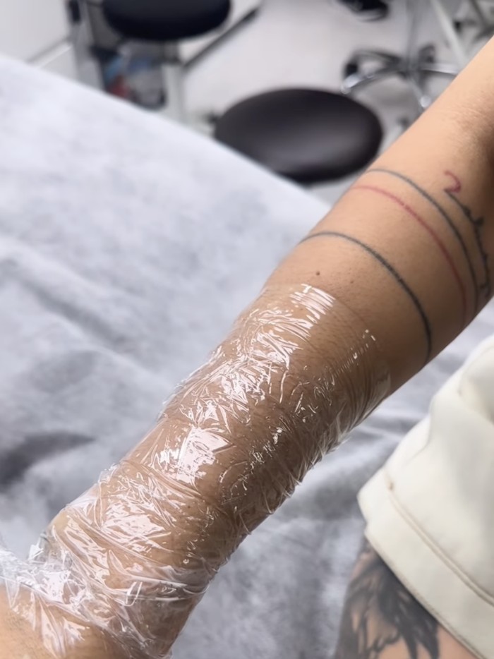 Momen ketika Sheila Marcia menahan sakit karena hapus tato.