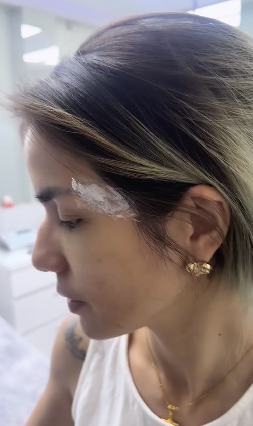 Momen ketika Sheila Marcia menahan sakit karena hapus tato.