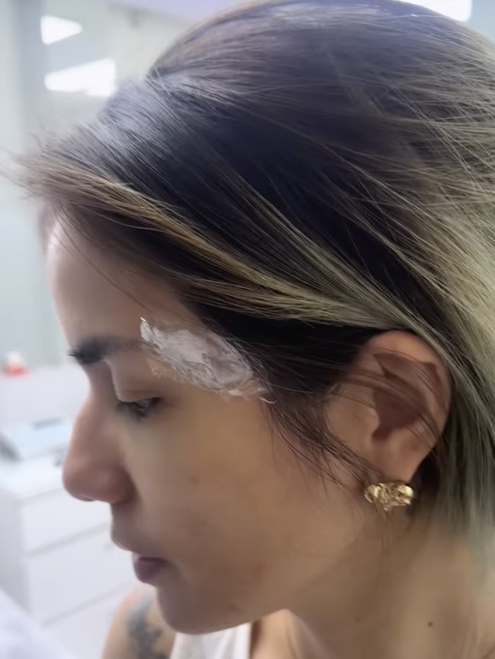 Momen ketika Sheila Marcia menahan sakit karena hapus tato.