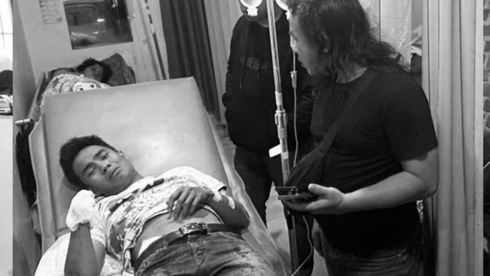 Pelaku yang hendak bobol rumah polisi pencurian di Lubuklinggau diamuk massa hingga tangan putus