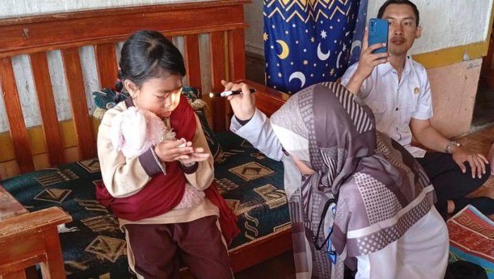 Syakira (7), bocah yang tak bisa mengedip di Sukabumi.