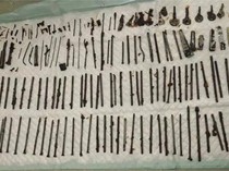 Ngilu! Dokter Temukan 120 Benda Asing di Perut Pasien, Ada Pisau-Gunting