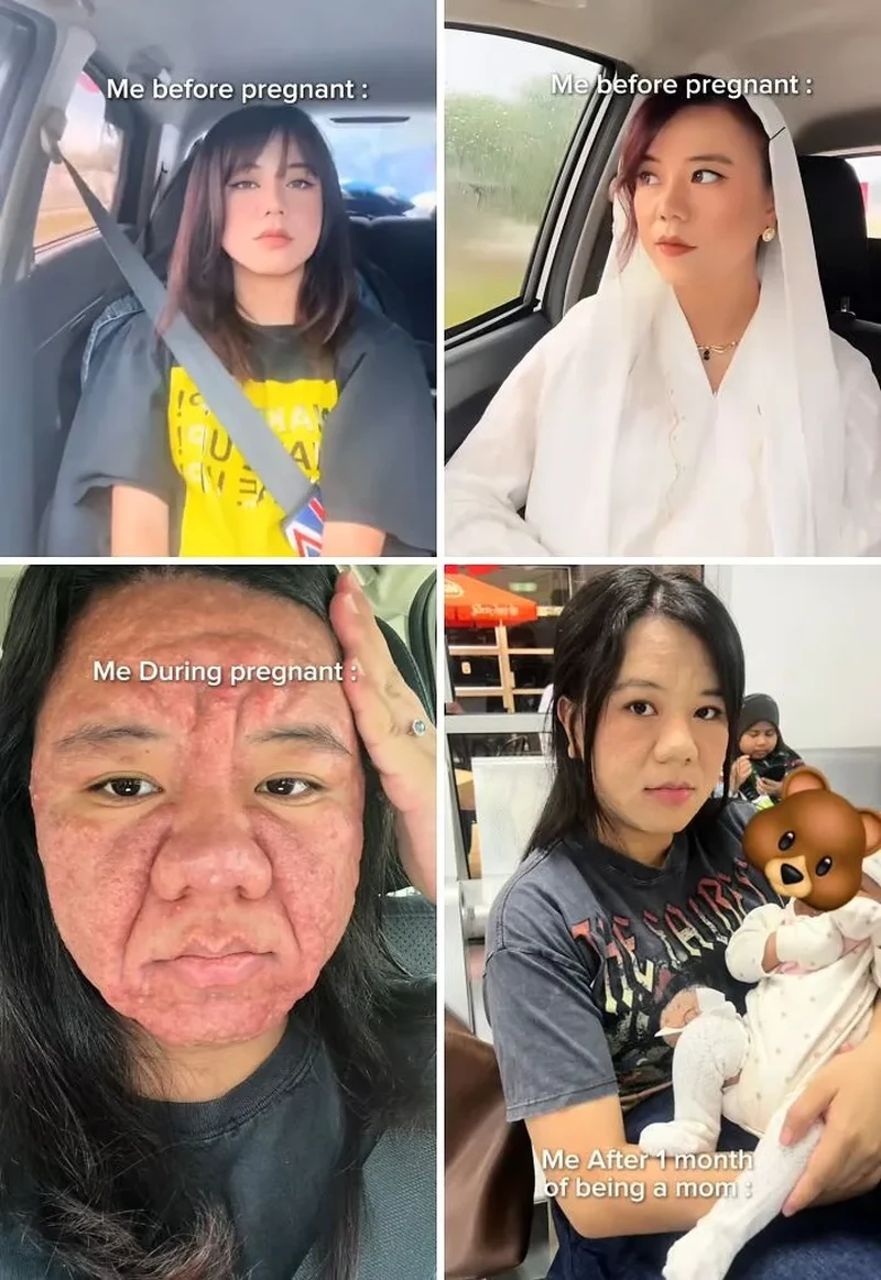 Transformasi sebelum menjadi ibu sampai menjadi figur tersebut tergambarkan dalam beberapa foto berikut. Banyak yang jadi benar-benar berbeda.