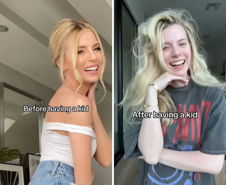 Transformasi sebelum menjadi ibu sampai menjadi figur tersebut tergambarkan dalam beberapa foto berikut. Banyak yang jadi benar-benar berbeda.