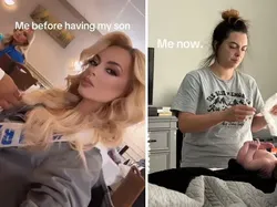 Before-After Melahirkan, Perjuangan Jadi Ibu Nggak Main-main!