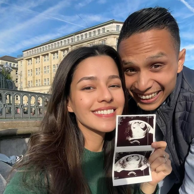 Gaya Artis Umumkan Kehamilan