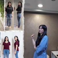 Transformasi Asmirandah Before-After Sedot Lemak, Makin Cantik dan Langsing