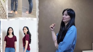 Transformasi Asmirandah Before-After Sedot Lemak, Makin Cantik dan Langsing