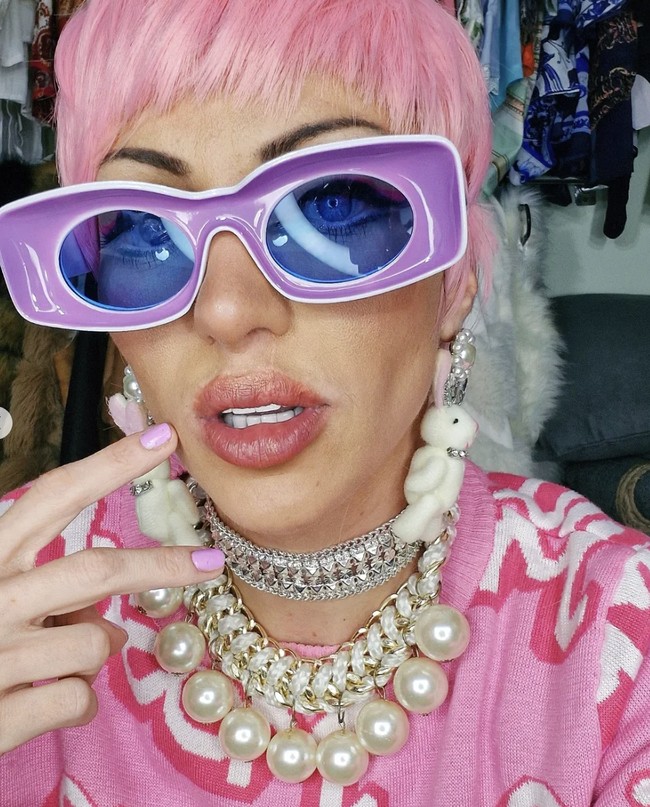 Di media sosial, Barbara aktif membagikan perjalanan transformasi fisiknya. Dia pun kerap membagikan pandangannya tentang standar kecantikan kontemporer yang menurutnya tidak masalah menjalani operasi plastik ekstrem sebagai bentuk ‘self love’. Foto: dok. Instagram @bonecadesumana