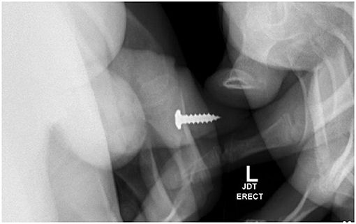 Bikin Ngilu, Penampakan Mr P Bocah 17 Tahun yang Dimasukkan Benda Asing Seorang remaja berusia 17 tahun memasukkan benda asing ke dalam uretranya sendiri. Tak hanya sekali, ia memasukkan total 20 kali hingga dilarikan ke UGD.
