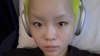 Before After Cocona XG Jalani Pengangkatan Payudara, Umumkan Identitas Baru