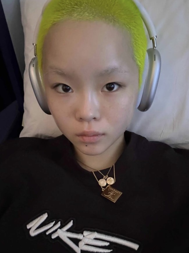 Before After Cocona XG Jalani Pengangkatan Payudara, Umumkan Identitas Baru